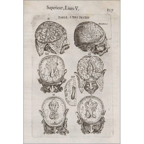 Surgery, 1649, "Les Oeuvres De Chirurgie De Jacques Guillemeau" (The Works of Surgery of Jacques Guillemeau).