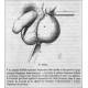 Rare 19th Century Chassaignac Surgical Testicle Castrator - 20 cms.